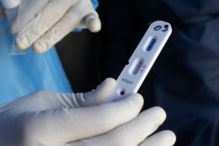 "Srpska nije mogla da računa na BiH u borbi protiv epidemije"