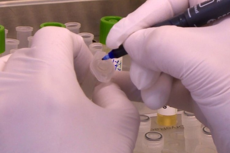 Izolovan virus Kovid-19 u zagrebačkoj klinici za infektivne bolesti