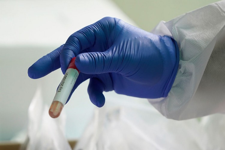 U FBiH zaražene još četiri osobe virusom korona
