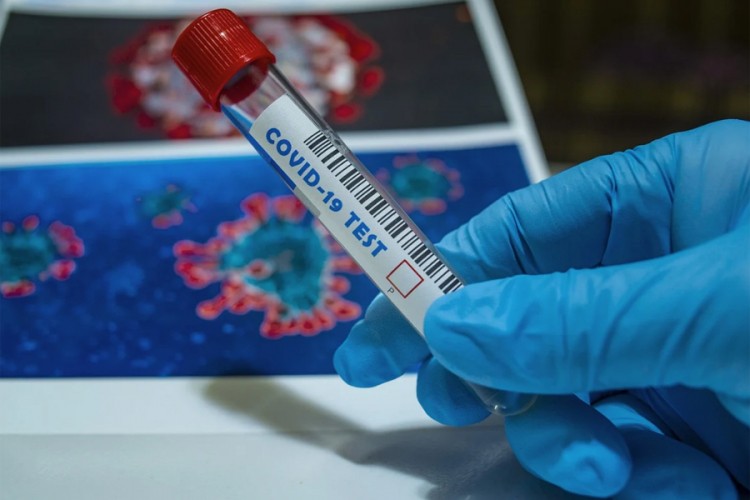 Na KCUS testiran 251 uzorak, jedna osoba pozitivna na virus korona