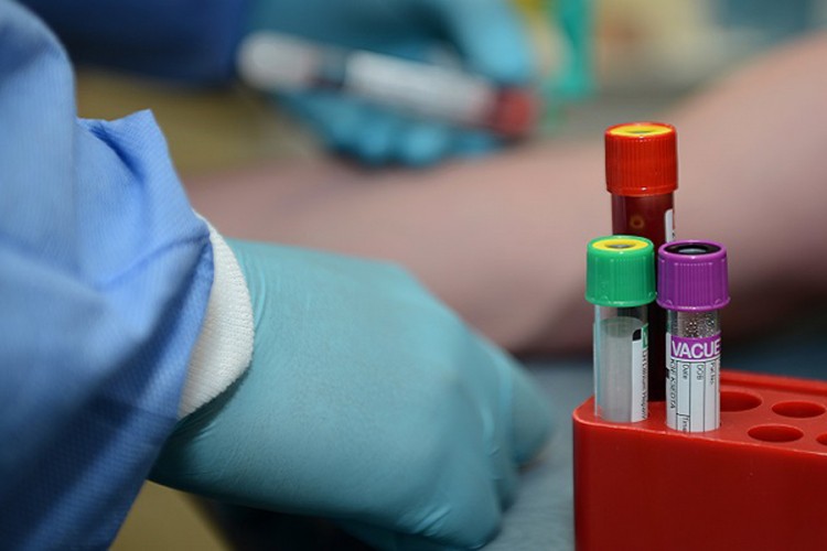 U FBiH još 25 slučajeva virusa korona, testirano 753