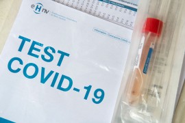 Preminule još četiri osobe u Srbiji