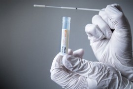 U Kantonu Sarajevo testirano 36 uzoraka, svi negativni