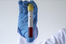 Iz BiH u Crnu Goru samo uz negativan test