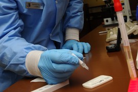 "U BiH nijedna laboratorija nije akreditovana za testiranje na Kovid-19"
