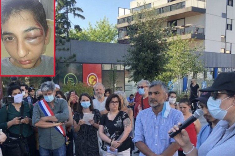 Pretučeni dječak iz Srbije hitno operisan