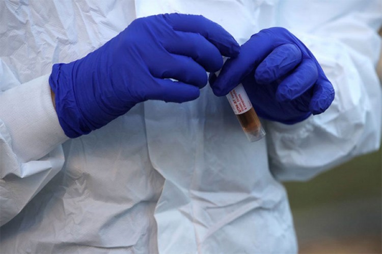 Pozitivne dvije osobe iz Tešnja i Sarajeva na virus korona