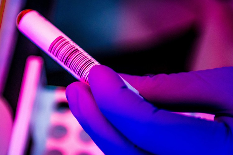 Antitijela na virus korona ima 6,7 odsto ljudi u Srbiji