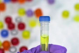 U Austriju samo uz negativan test ili u karantin 14 dana