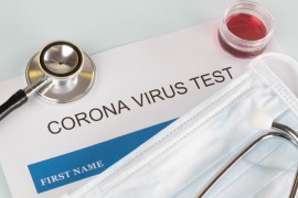 Od 93 uzorka testirana na KCUS čak 40 pozitivnih