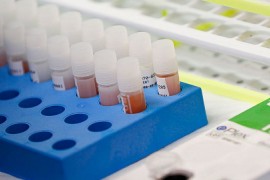 U BiH zaražena 7.681 osoba