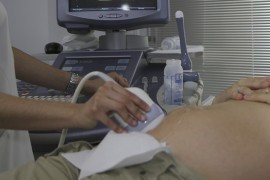Pacijentkinja tvrdi da ju je ginekolog ljubio bez dozvole