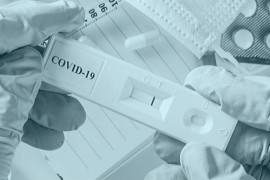 U Hrvatskoj pada cijena testova za koronu