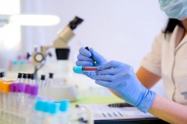 U Grčkoj 28 novih slučajeva, jedna osoba preminula