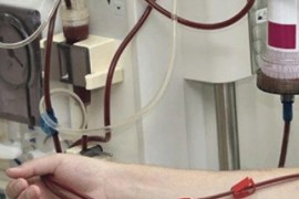 Hemodijaliznim pacijentima u Sanskom Mostu sve teže, korona odnosi ...