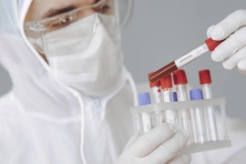 Dvije osobe preminule u Crnoj Gori, još 116 oboljelih