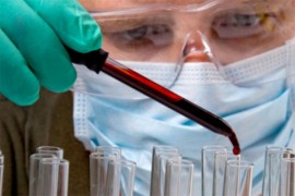 Naučnici napravili test za otkrivanje karcinoma