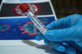 Institut počinje komercijalno testiranje, cijena 200 KM