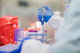 Ukida se retestiranje u RS: Pacijent se smatra izliječenim ako nema ...