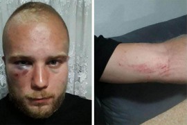 Srbinu prepriječili put i brutalno ga pretukli u Crnoj Gori