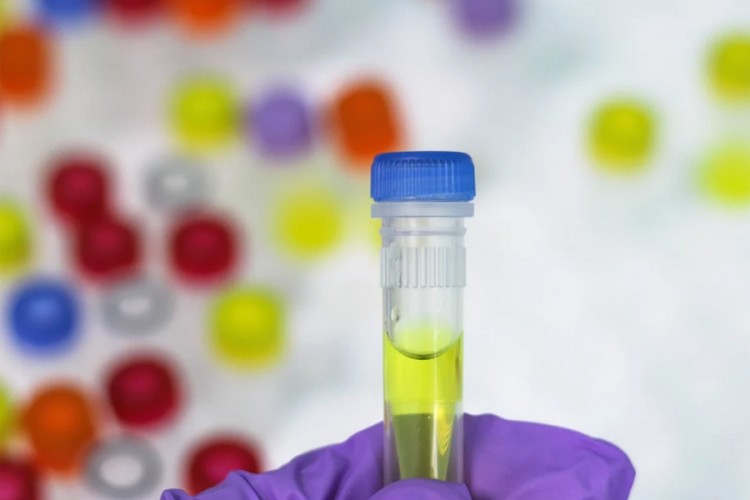 U Austriju samo uz negativan test ili u karantin 14 dana