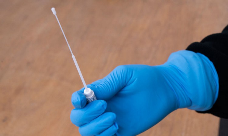 Na KCUS-u testirano 210 uzoraka, 40 pozitivnih, jedna osoba preminula