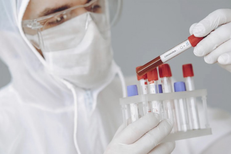 Nijemci razvili novi brzi test za koronu