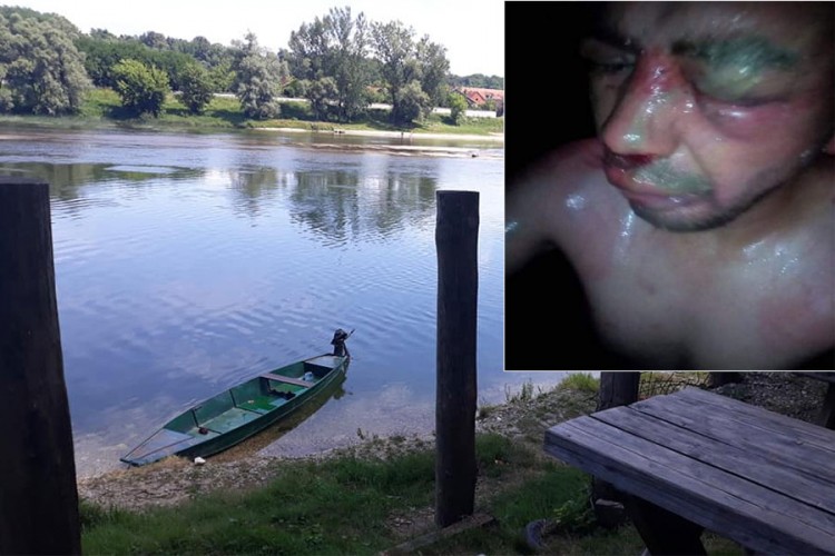 Brutalno pretukli bolesnog mladića u Kozarskoj Dubici, sve snimali
