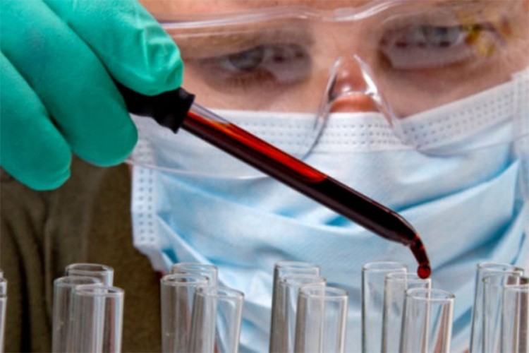 Naučnici napravili test za otkrivanje karcinoma