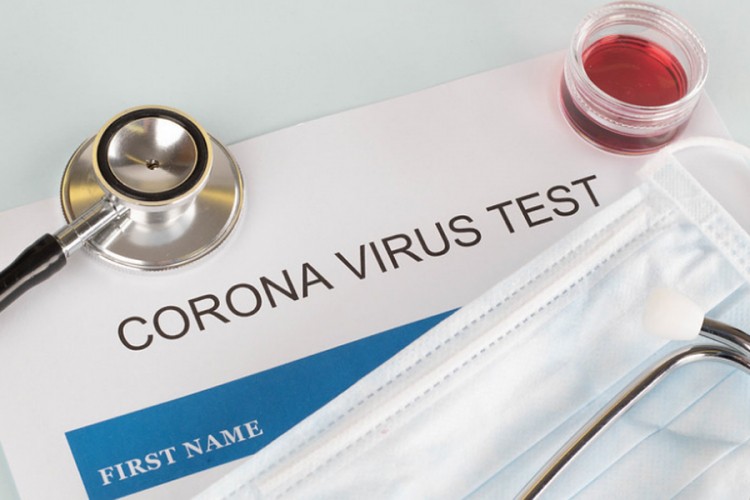 Još 78 pozitivnih na virus korona na KCUS
