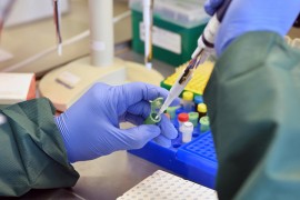 Komercijalno testiranje na virus korona od sutra jeftinije i u FBiH