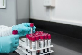 Zeljković: Urađeno više od 4.000 komercijalnih testiranja