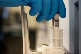 U Han Pijesku počeo s radom aparat za serološka testiranja