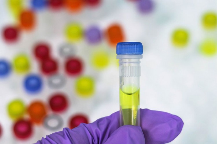 Veliko interesovanje Beograđana za PCR testiranje na lični zahtjev