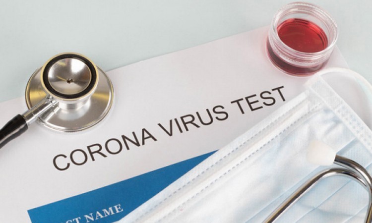 Četiri falsifikatora PCR testova priznala krivicu