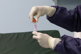 KCUS: Još 17 slučajeva zaraze kovidom-19