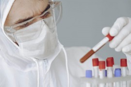 Studija s Oksforda: Infekcija koronom traje sedam dana