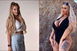 Ima 22 godine i potrošila je brdo para na plastične operacije