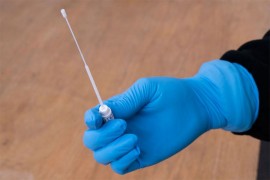 KCUS: Još 18 pozitivih na virus korona
