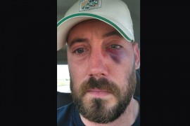 "Petar Strugar mi je polomio vilicu, on je incidentna ličnost"