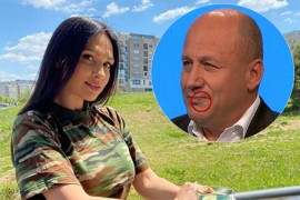 General Dragiša Simić: Povreda na usni plod ljubomore Ljupke Stević