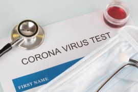 Skoro 30 zaraženih u Karlovcu povezano sa crkvenim horom