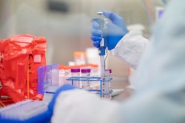 KCUS: Od 289 testiranih, na virus korona pozitivno 12 uzoraka