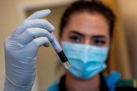 U Hrvatskoj još 393 zaraženih koronom, 11 preminulih