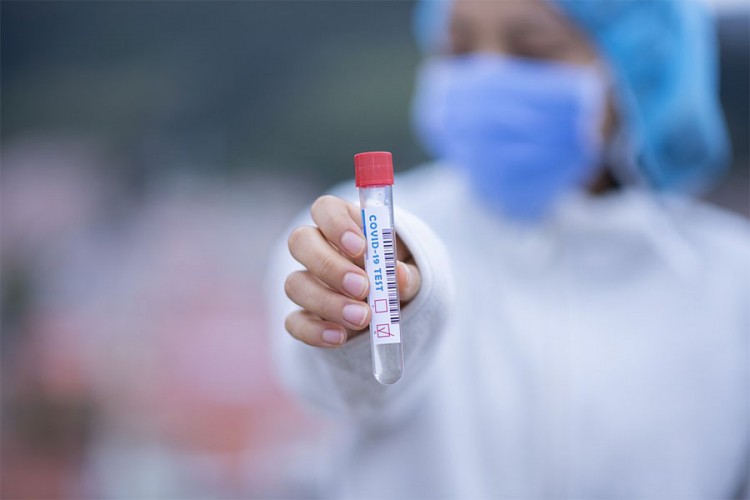 Testovi koji razlikuju grip od korone čekaju stav mikrobiologa