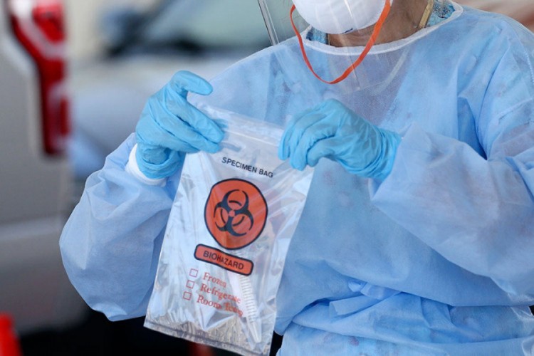 Još 129 osoba u Srpskoj pozitivno na virus korona