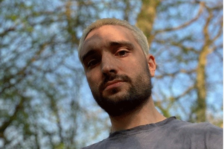 Tom Parker objavio da ima tumor na mozgu