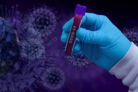 Od 497 testiranih uzoraka u KCUS 163 pozitivno na virus korona