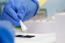 Serološko testiranje u dva banjalučka naselja po nasumičnom odabiru