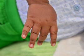 Policija uhapsila medicinske radnike zbog krađe beba u Keniji